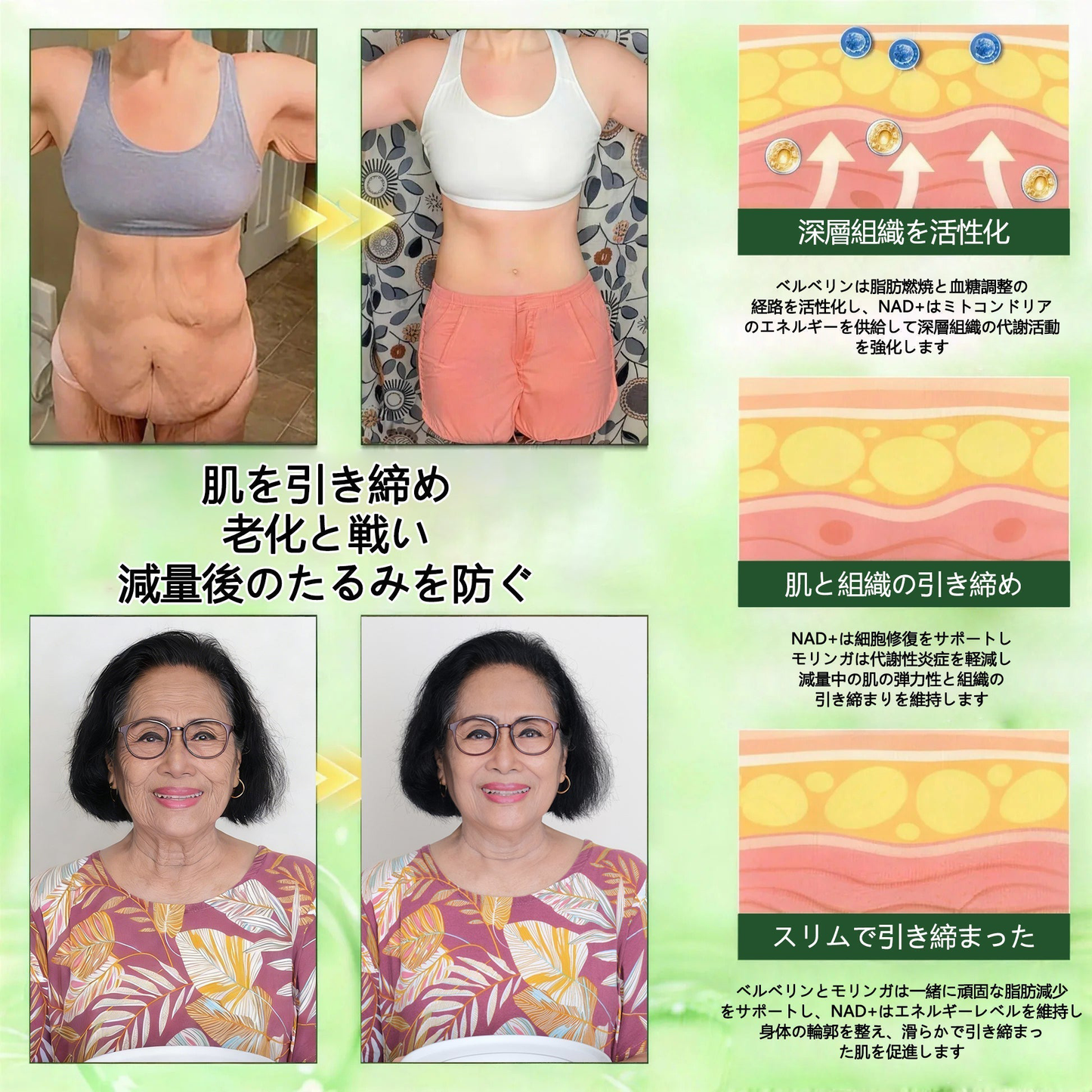 👑Solaroza® リンパドレナージュ用ナノマイクロニードルスリミングパッチ｜5倍高濃度リポリティックペプチドコンプレックス配合｜ダイエット・リンパの流れをサポート｜関節ケア・快適な睡眠・クリアな毎日をサポート